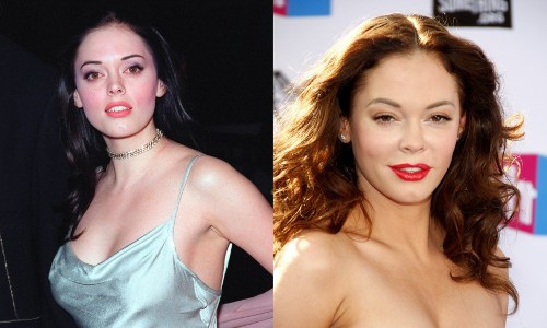 Nữ diễn viên Rose McGowan đã biến mình từ đẹp thành xấu sau khi  phẫu thuật thẩm mỹ vào năm 2017. Nhiều người còn châm chọc cô giống như Michael Jackson.